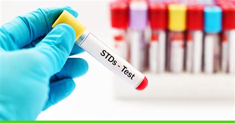 positive impact std testing|Testing – HIV, STDs and Viral Hepatitis .